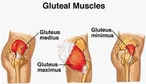 Gluteal Tendinopathy Gluteal Tendinopathy